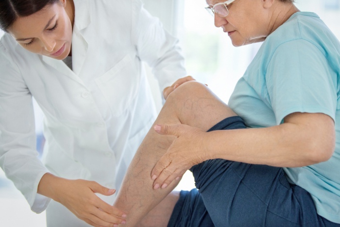 Doctor examining the leg of a senior female patient with visible varicose veins.