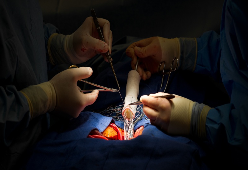 Traditional heart valve surgery care at Cardiovascular Specialists of New England